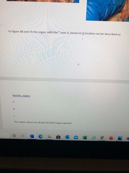 In Figure 68 and 7A the organ, with the * over it, based on it location can be described as: 6 Identify organs 8. b C. The or