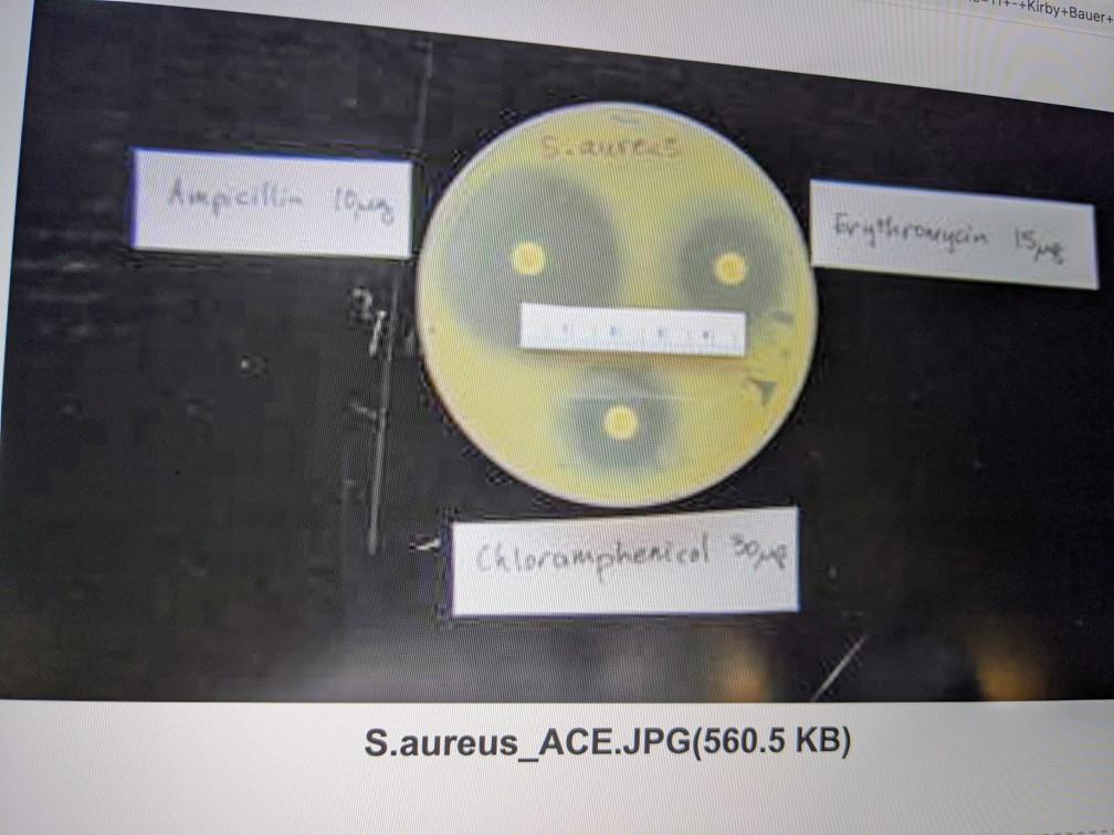 Disk Diffusion Results Diameter of Zone of Inhibition | Chegg.com