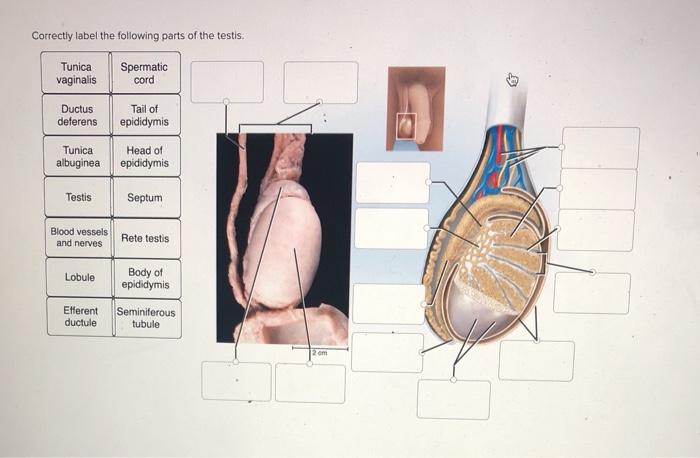 Solved Correctly label the following parts of the testis. | Chegg.com