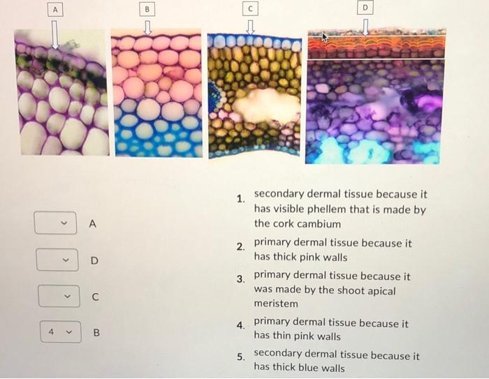 Solved The Images Below Are Showing Different Types Of | Chegg.com