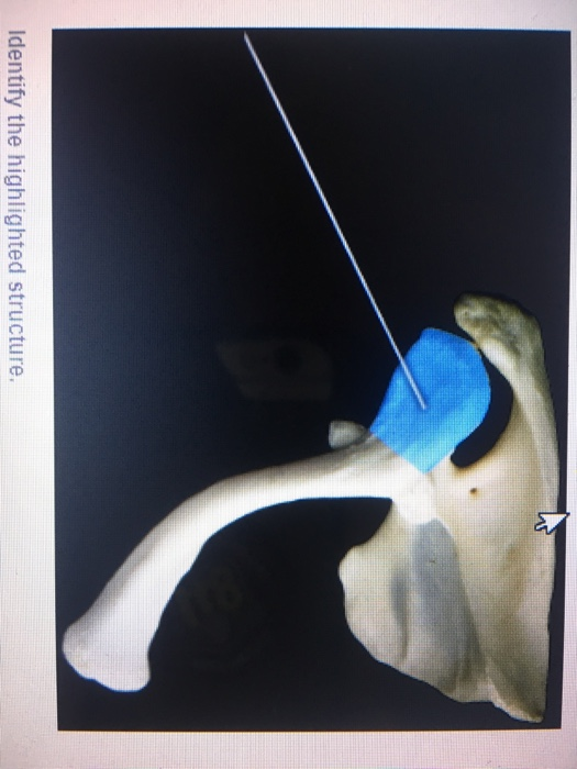 Solved Appendicular Skeleton: Pectoral Girdle > Lab | Chegg.com