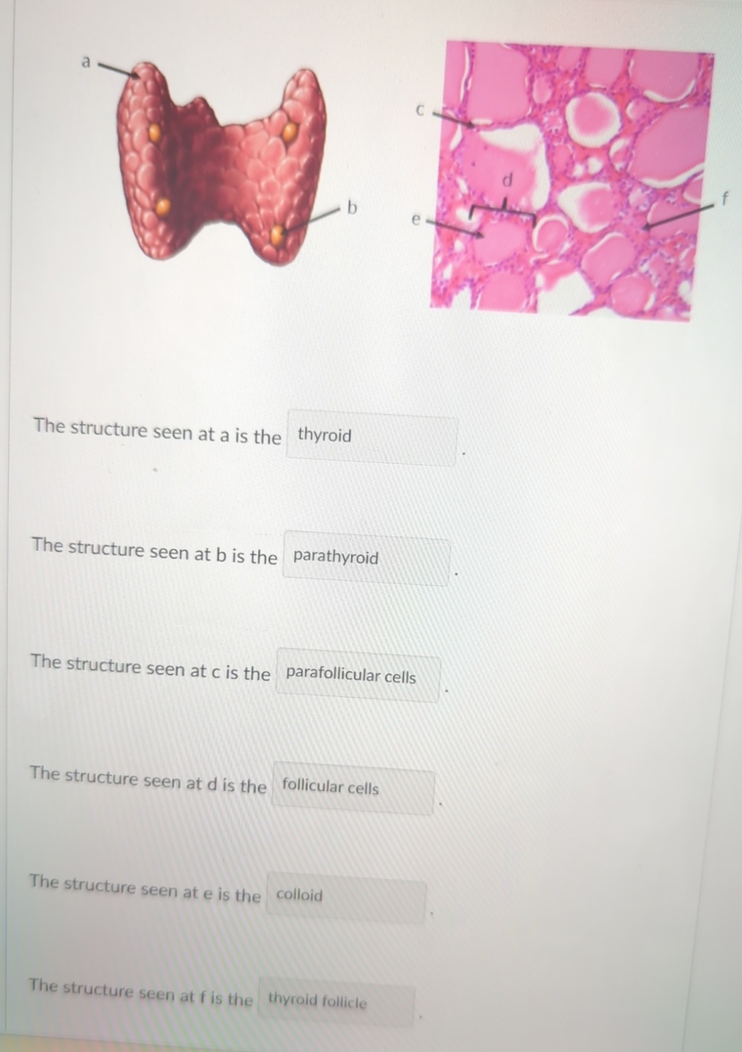 Solved The structure seen at a ﻿is theThe structure seen atb | Chegg.com