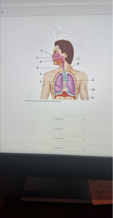 Solved Label 1-11 | Chegg.com