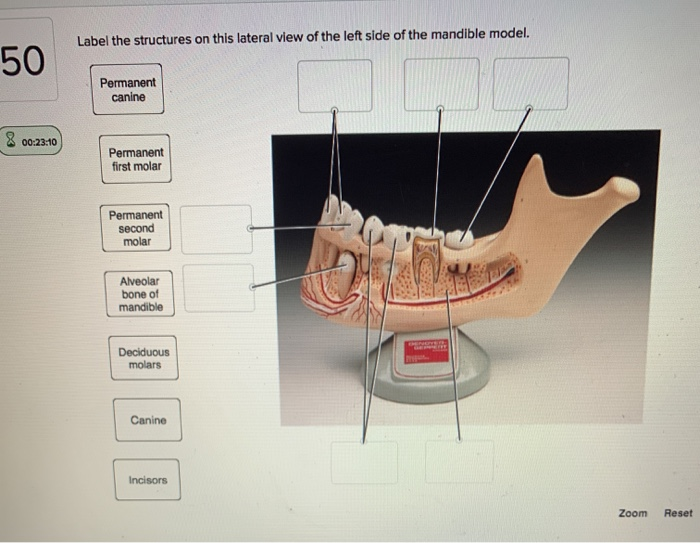 Solved Label the structures on this lateral view of the left | Chegg.com