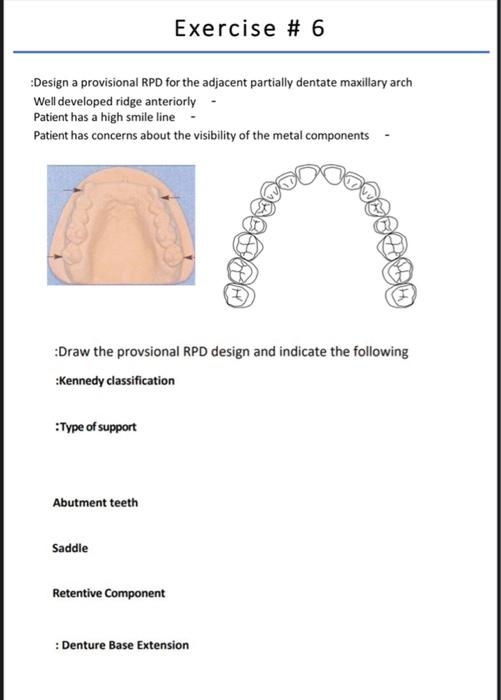 Solved Exercise 5 Design a provisional RPD for the