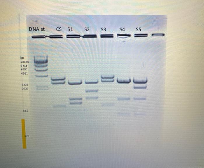 Solved DNA st CS S1 S2 S3 S4 S5 bp 23130 9416 6557 4361 2322 | Chegg.com