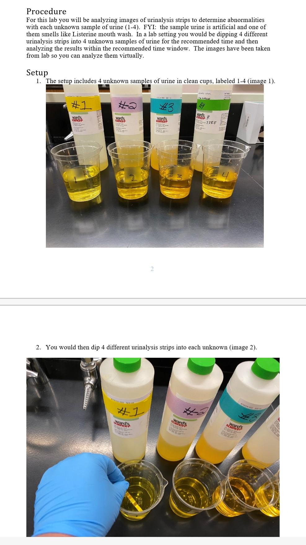 Solved Urinalysis Lab Blood composition depends largely on | Chegg.com