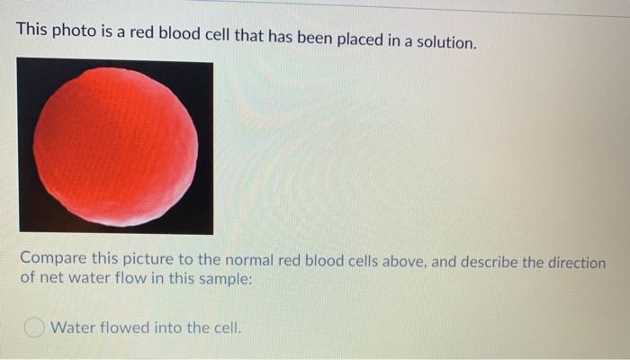 Solved This photo is of red blood cells that have been | Chegg.com