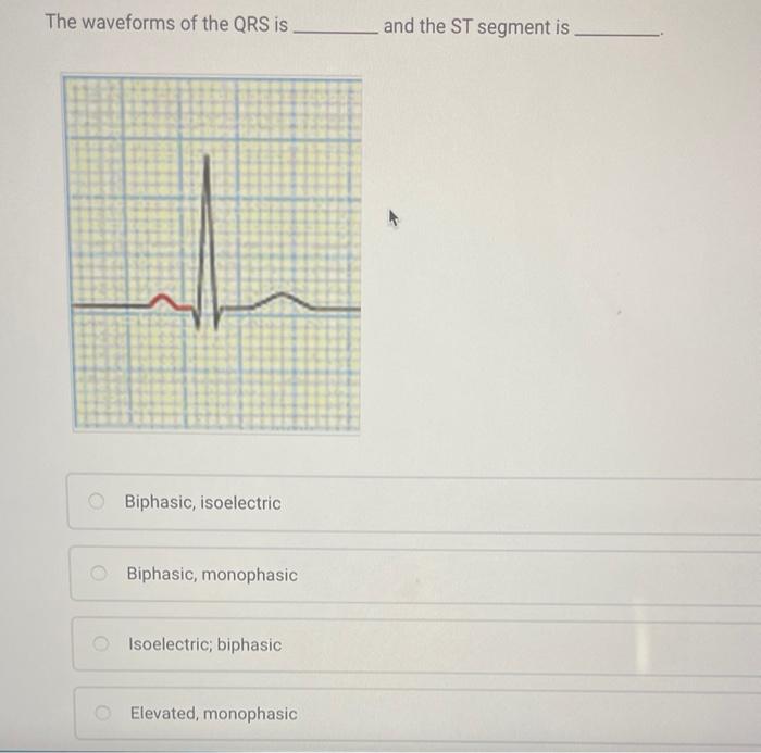 The waveforms of the QRS is.
Biphasic, isoelectric
OBiphasic, monophasic
Isoelectric; biphasic
O Elevated, monophasic
and the