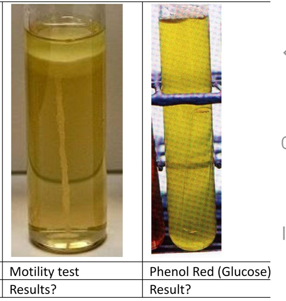 Solved Motility test Results? Phenol Red (Glucose) Result? | Chegg.com