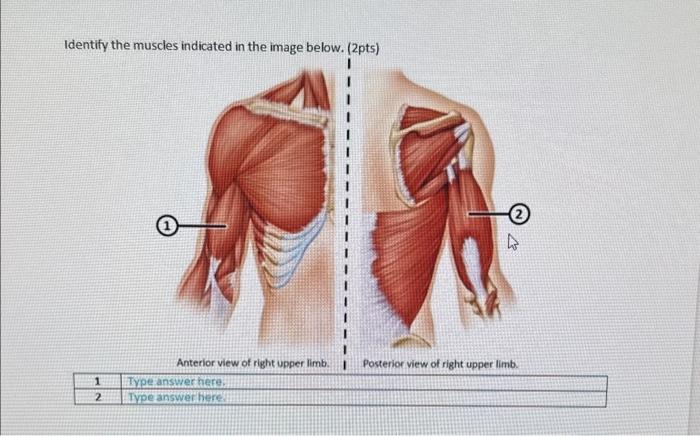 Solved Identify the muscles indicated in the image below. | Chegg.com