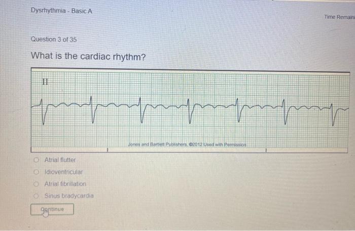 Solved Dysrhythmia - Basic A Time Remain Question 3 of 35 | Chegg.com