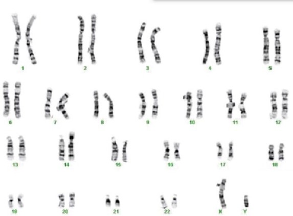 Solved Can I please get help with this Patient A becomes | Chegg.com