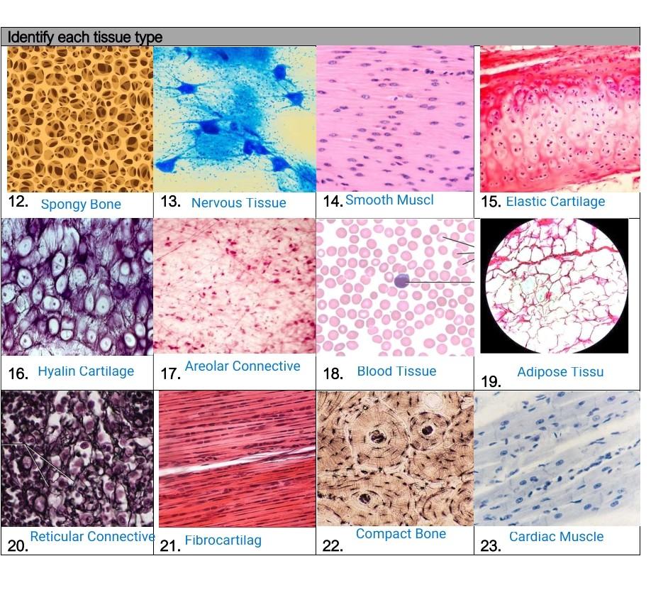 Solved histology tissue name the tissue | Chegg.com