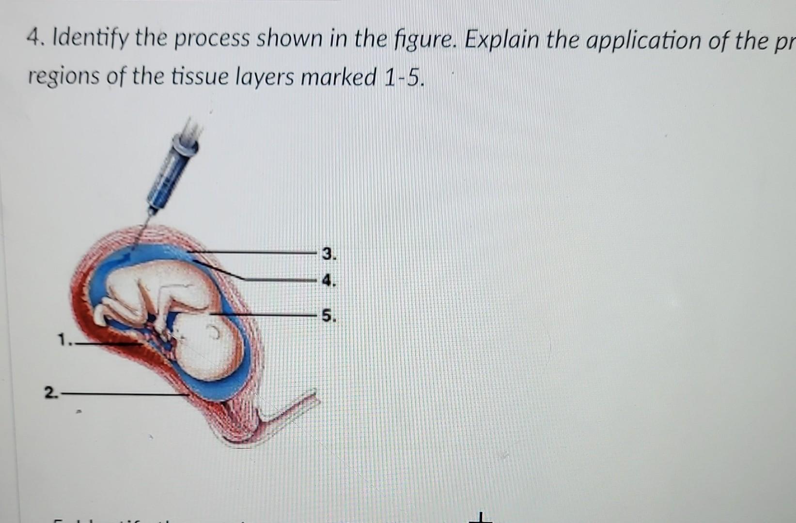 Solved 4. Identify the process shown in the figure. Explain | Chegg.com