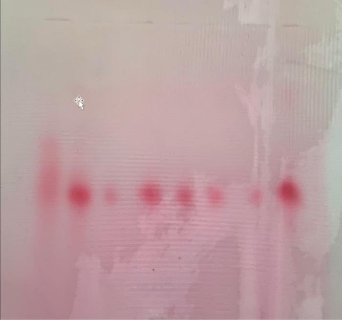 [Solved] so we did a hemoglobin electrophoresis and i dont