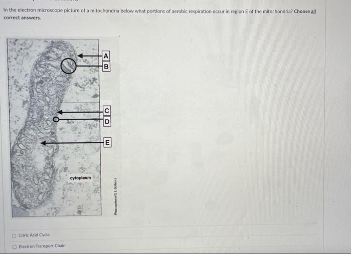 Solved In the electron microscope picture of a mitochondria | Chegg.com