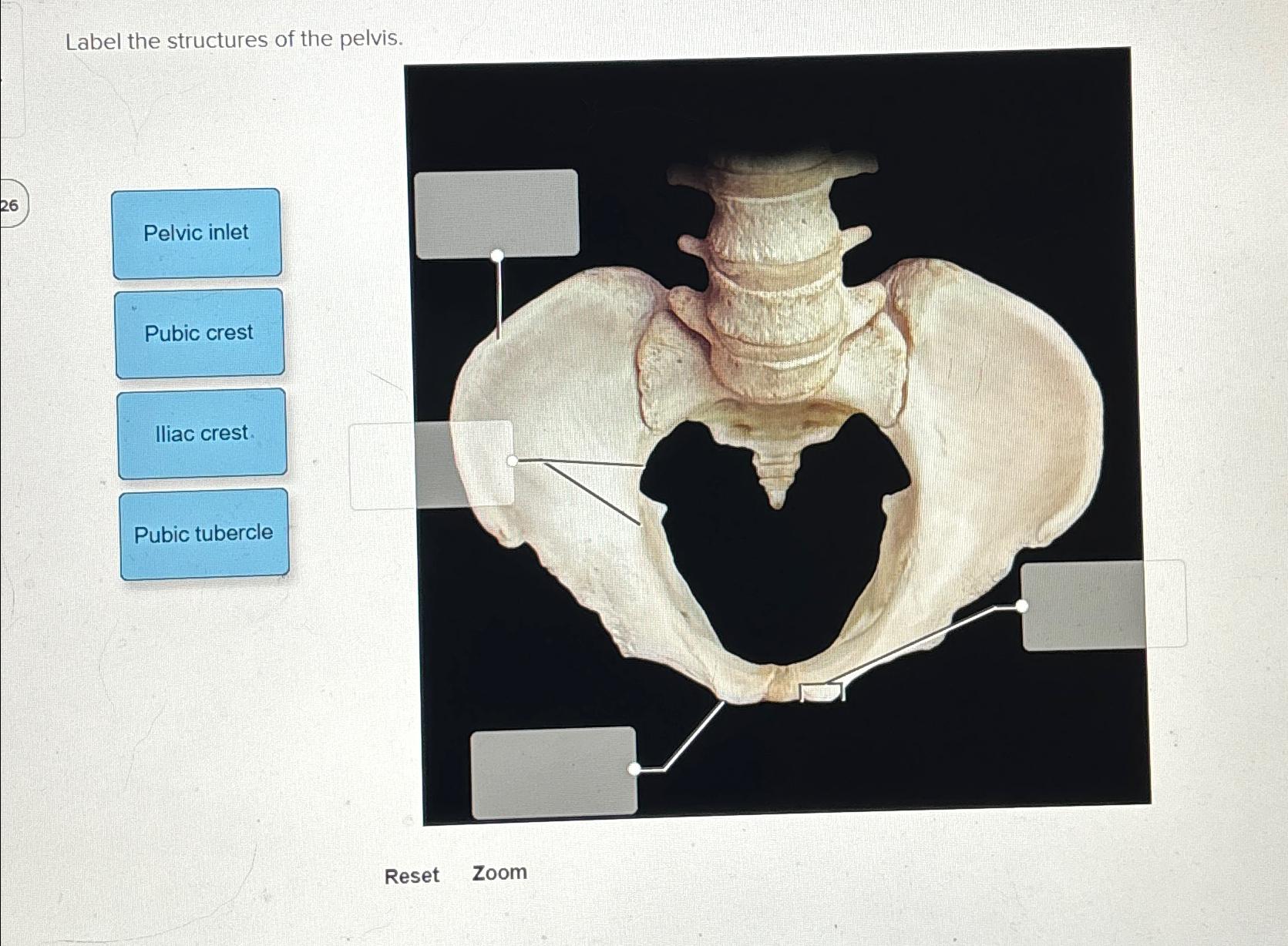 Solved Label the structures of the pelvis.ResetZoom | Chegg.com
