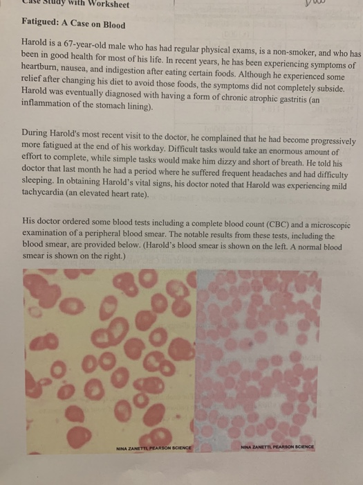 Doctors have determined that harold is anemic picture