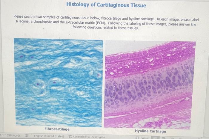 Histology of Cartilaginous Tissue
Please see the two samples of cartilaginous tissue below, fibrocartilage and hyaline cartil