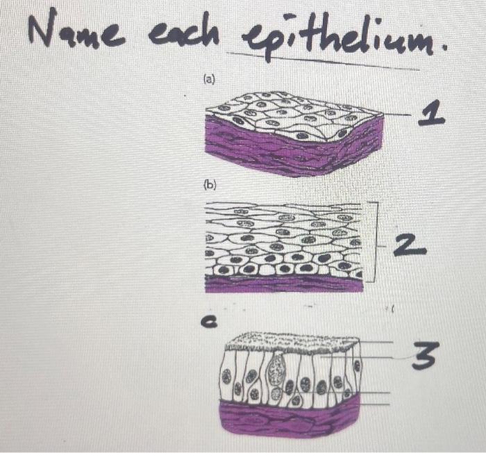 Solved h epithelium | Chegg.com