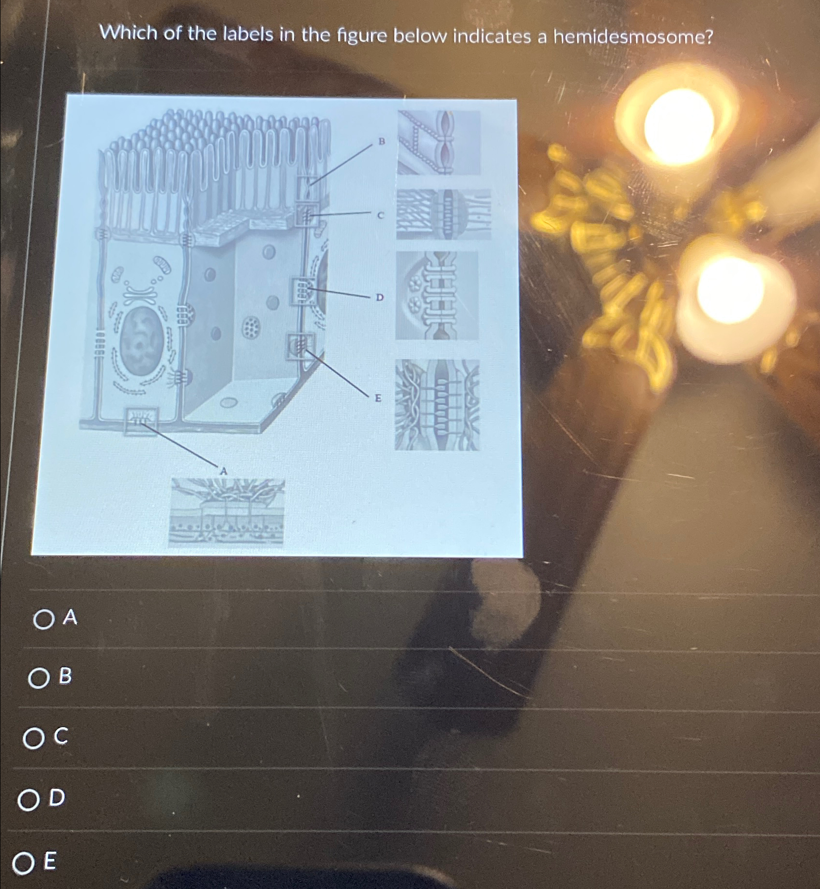 Solved Which of the labels in the figure below indicates a | Chegg.com