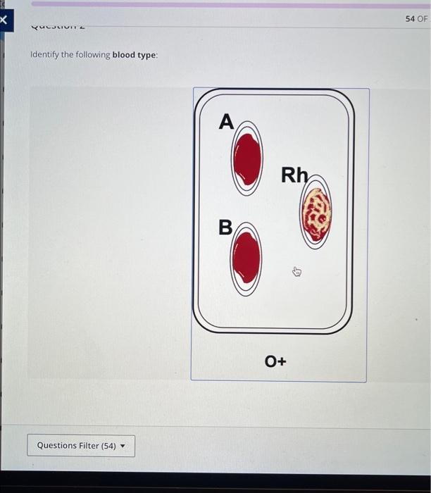 Solved Identfy the following blood type Identify the | Chegg.com