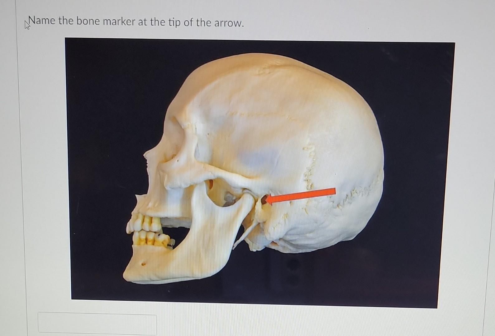 Tip Bone Solved Name the bone marker at the tip of the arrow. Name | Chegg.com
