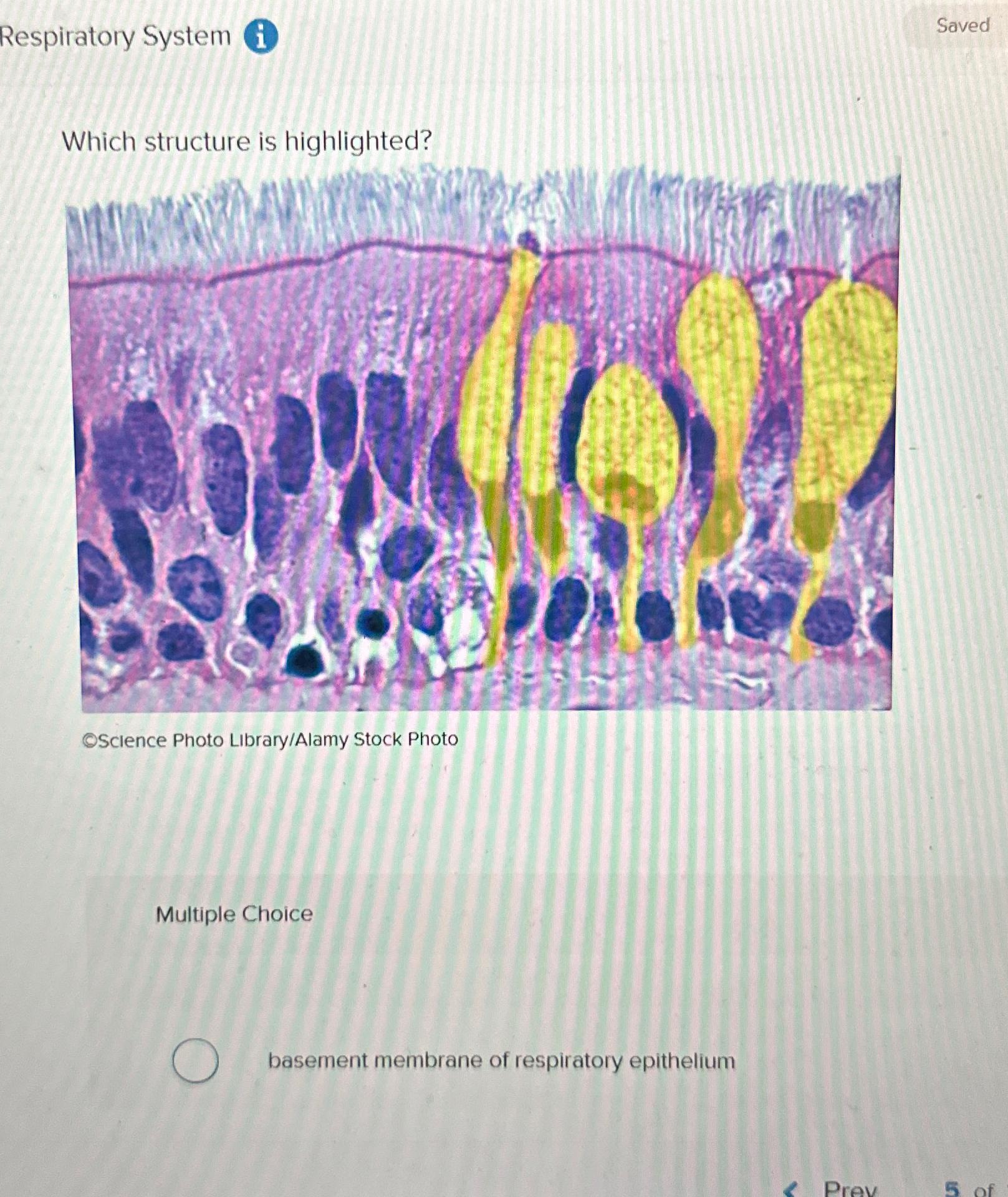 solved-respiratory-system-i-savedwhich-structure-is-chegg