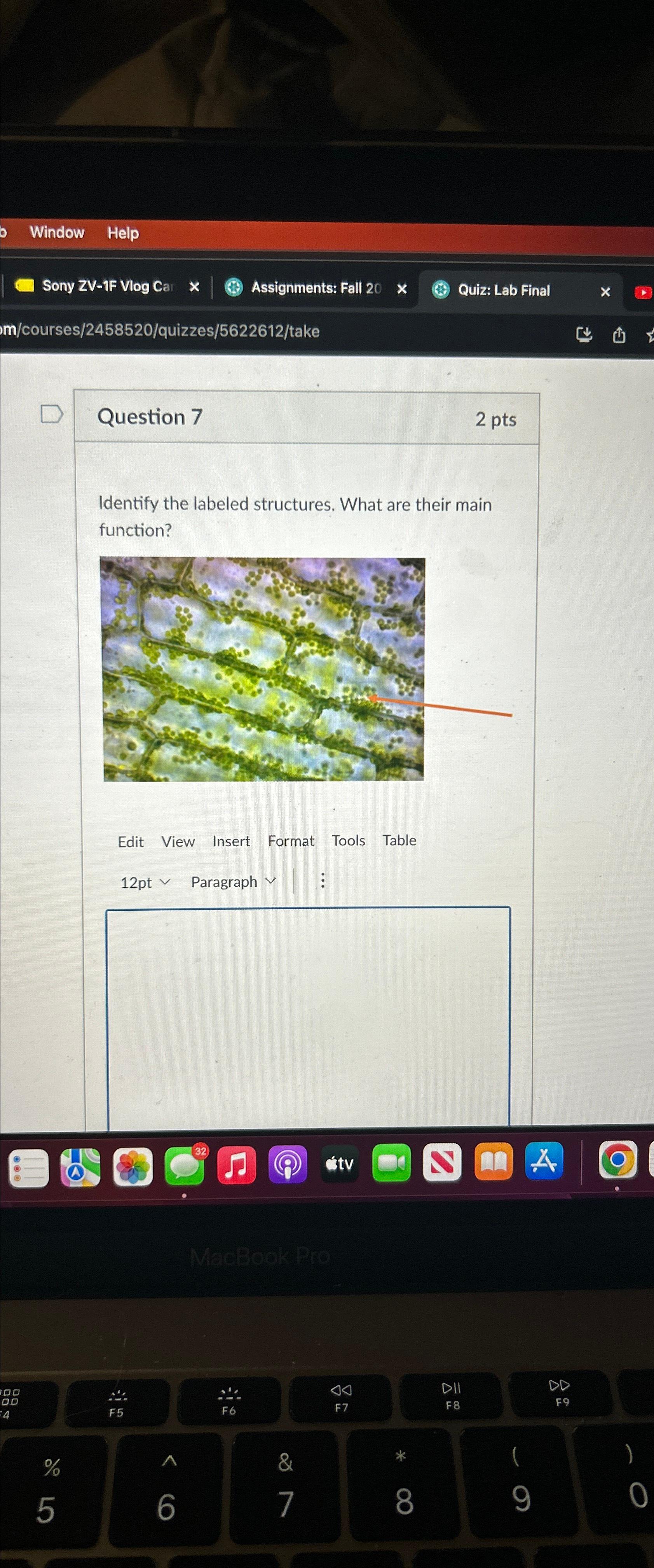 Solved Question 72 ﻿ptsIdentify the labeled structures. What | Chegg.com