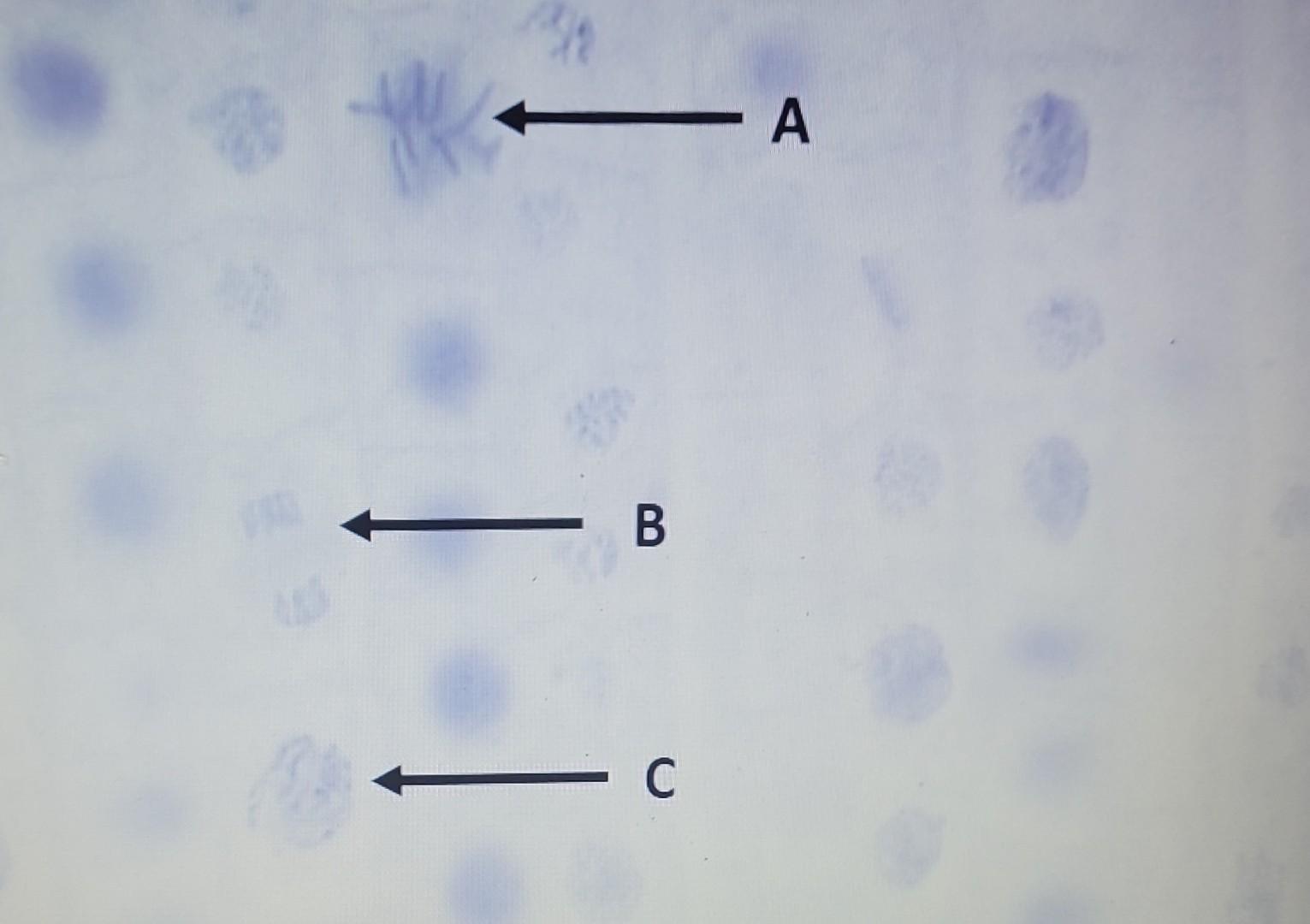 Prophase Labeling Question Solved E F G | Chegg.com
