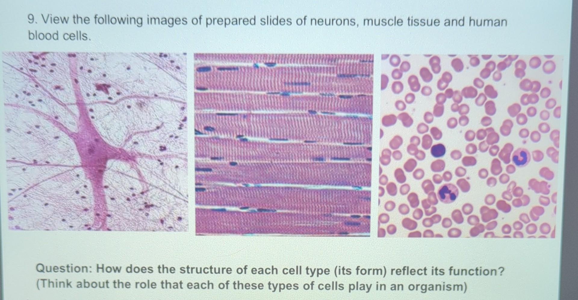 Solved 9. View the following images of prepared slides of