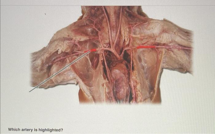 Which artery is highlighted?