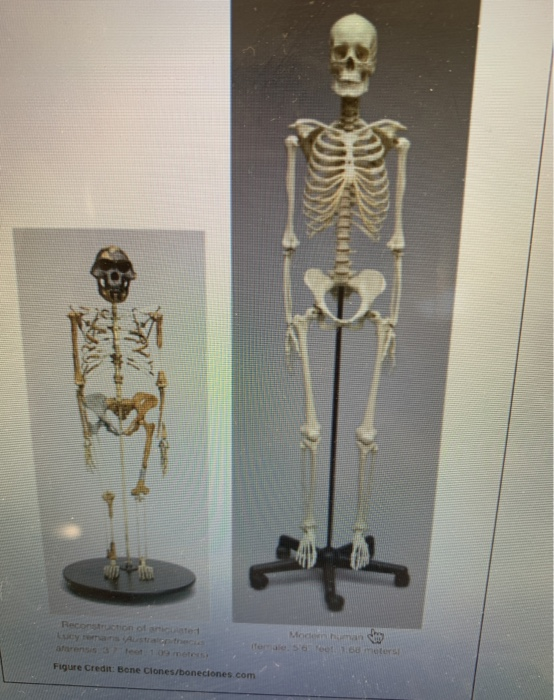 Corsets and Skeletal Deformities: Anthropological Study – Lucy's