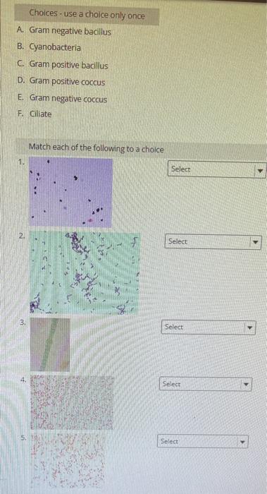 Choices - use a choice only once
A. Gram negative bacillus
B. Cyanobacteria
C. Gram positive bacillus
D. Gram positive coccus