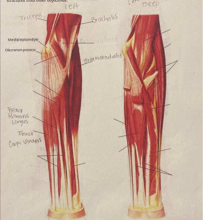 Solved Triceps Medial epicondyle Olecranon process. Flexor | Chegg.com