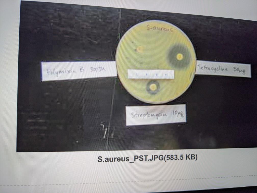 Disk Diffusion Results Diameter of Zone of Inhibition | Chegg.com
