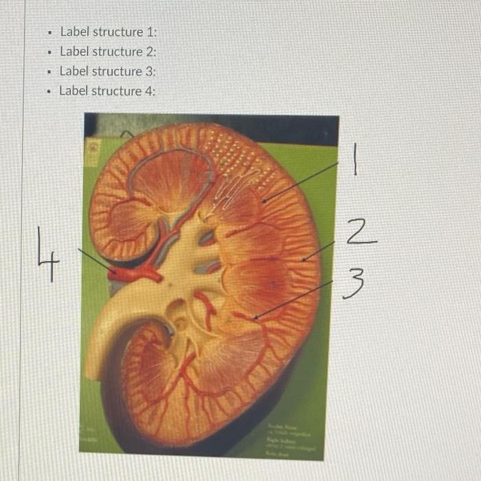 Solved . Label structure 1: • Label structure 2: Label | Chegg.com