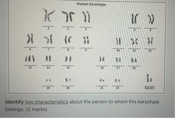 Solved Human Karyotype Kr 76 11 >) 5 ) 31 (( # 10 12 13 14 | Chegg.com