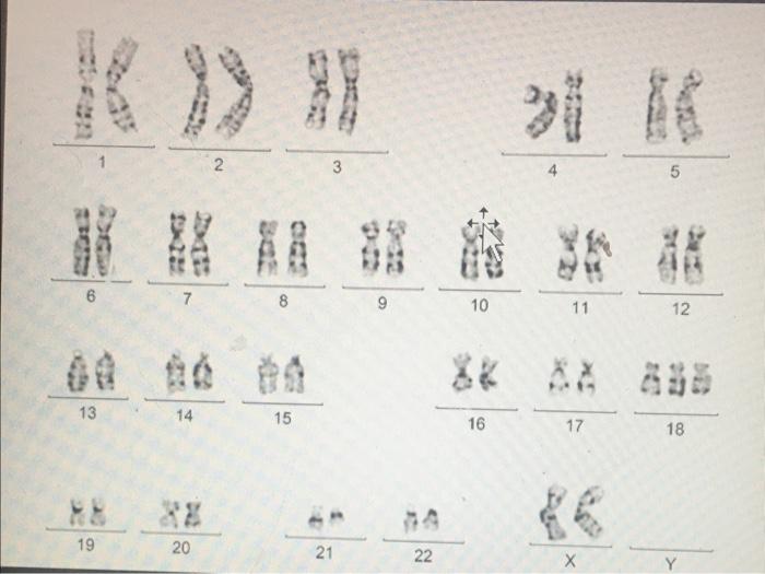 Solved Identify the biological gender and any chromosomal | Chegg.com
