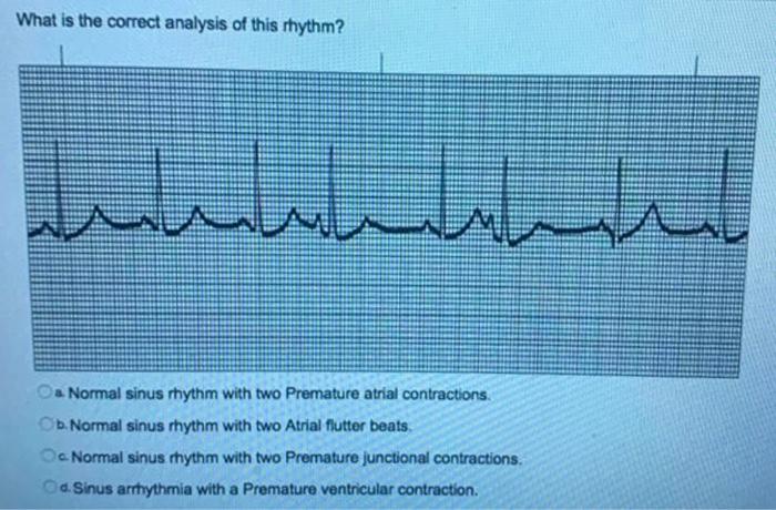 Solved What Is The Correct Analysis Of This Rhythm اسرار Chegg Com