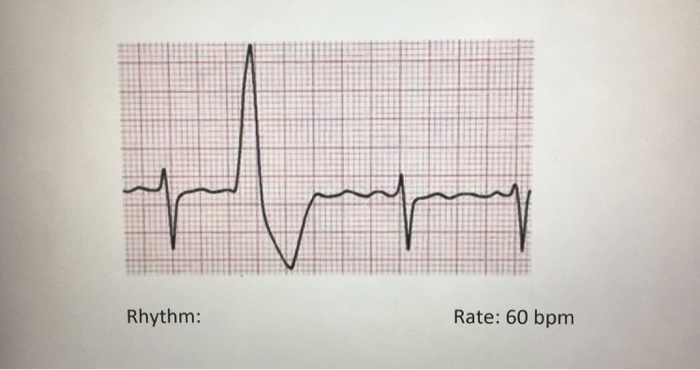 Solved Classify the heart rhythm and calculate the heart | Chegg.com