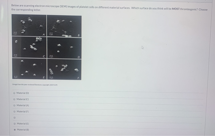 Solved Below are scanning electron microscope (SEM) images | Chegg.com