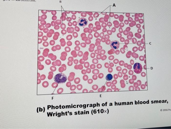 B А с D E F 2016 Pe (b) Photomicrograph of a human blood smear, Wrights stain (610x)