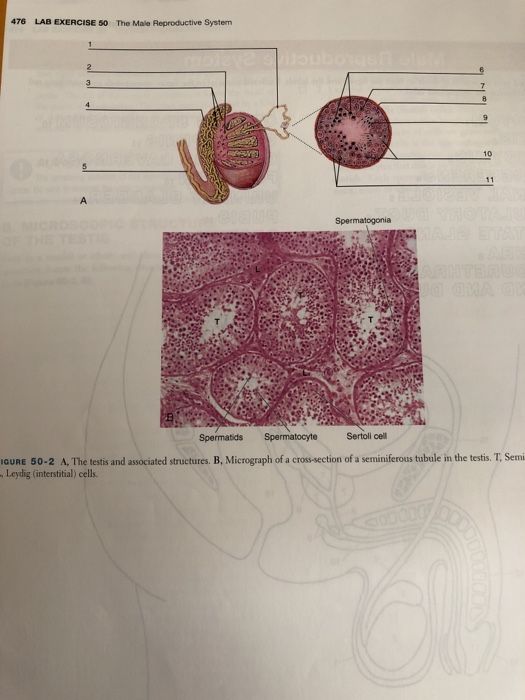 Solved 476 LAB EXERCISE 50 The Male Reproductive System | Chegg.com