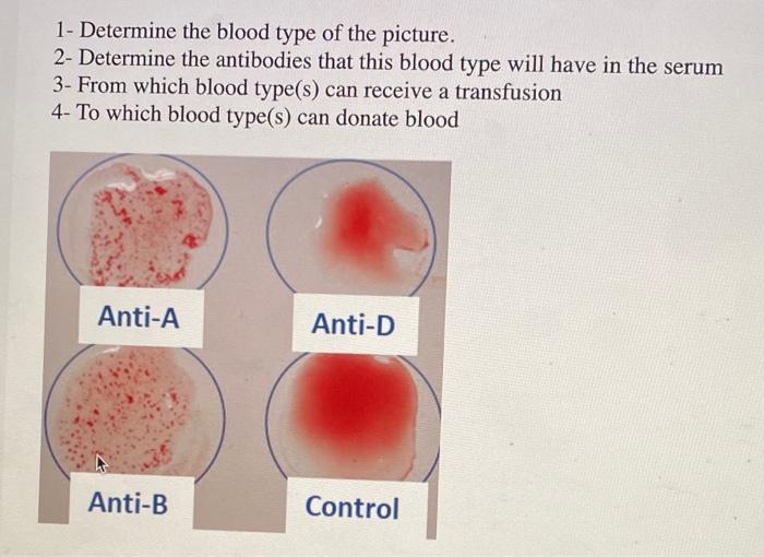 Solved 1- Determine The Blood Type Of The Picture. 2- | Chegg.com