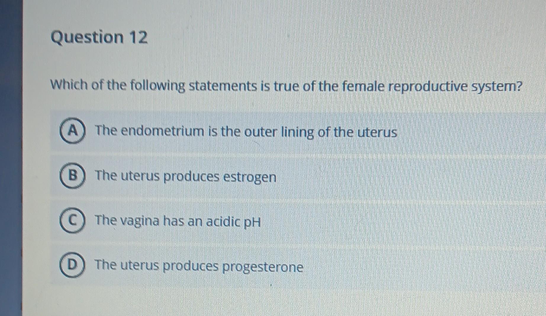 Solved Which Of The Following Statements Is True Of The | Chegg.com