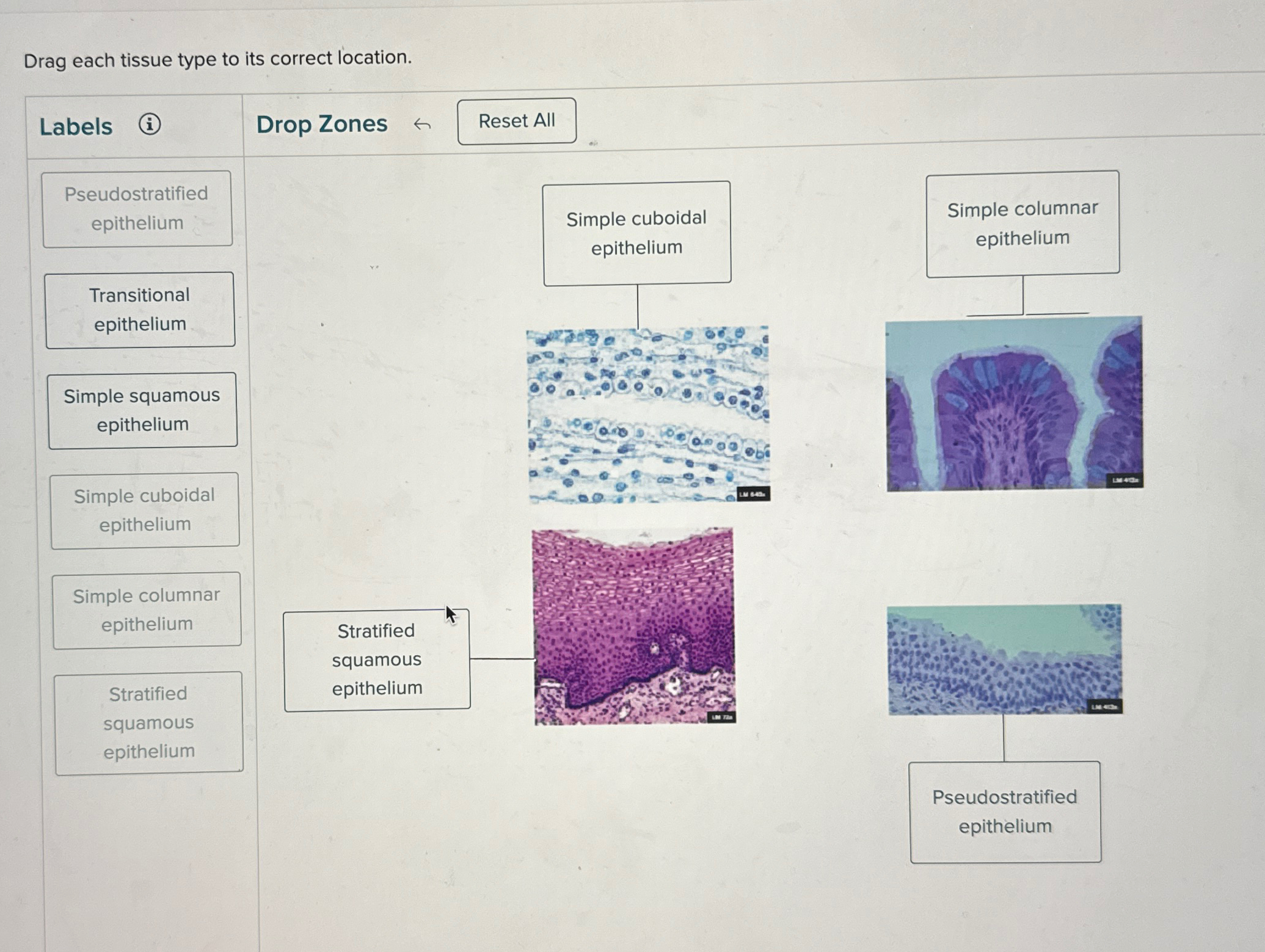 Drag each tissue type to its correct location. | Chegg.com