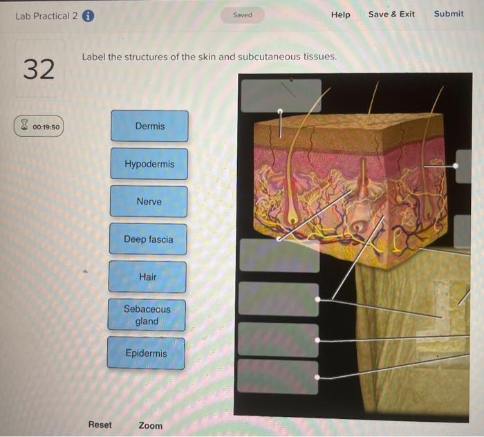 Solved Label the structures of the skin and subcutaneous | Chegg.com