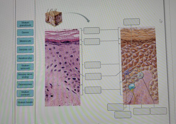 Solved Stratum granulasum Dermis Melanocyte Dendritical | Chegg.com